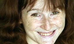 基因讓他們不一樣  遺傳疾病少年的笑顏寫真 Rick Guidotti、 攝影、 遺傳疾病、 青少年、 Positive Exposure