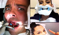 大明星也是人！看牙齒還不忘美麗自拍 牙齒、牙醫、明星