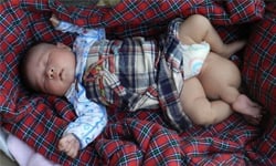 會長大的第三條腿？！三腳寶寶事件簿 寄生、雙胞胎、連體嬰、第三條腿、第三隻腳