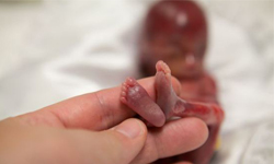 震撼世界的短暫生命 19週早產兒的故事 早產、流產、墮胎、生命、懷孕