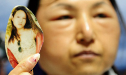 可以來個還我漂漂拳嗎？蘋果肌整形失敗少女變阿桑 整形、手術