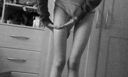 沒有大腿縫讓人憂鬱？專家破解大腿縫迷思 大腿縫、瘦身、減肥、健康