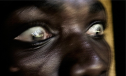 瘋狂是傳染病 José Cendón非洲瘋人院攝影集 攝影、瘋人、瘋人院、精神病、精神病院