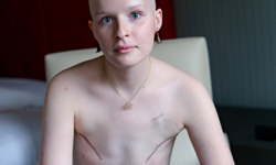 不只是粉紅絲帶而已　那些戰勝乳癌的勇敢女孩們《The Scar Project》 乳癌、The Scar Project、David Jay、攝影、癌症