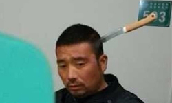 鐵頭淡定哥參上　頭扎利刃自行就醫奇聞 中國、吉林、延吉、醫院、淡定、冷靜、水果刀、利刃、就醫、奇聞、吉林淡定哥、Ho Lung