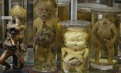 百萬件畸形生物包圍 法國畸形博物館有膽請來！ Guillaume Dupuytren、Musée Dupuytren、法國畸形博物館