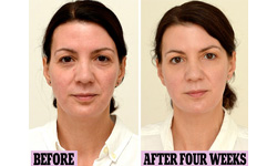 沒事多喝水還可以變年輕？不可思議的回春實驗    實驗、喝水、英國、每日郵報