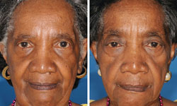 抽菸影響有多大？雙胞胎示範給你看！ 抽菸、研究、尼古丁、雙胞胎