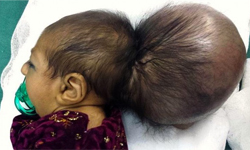 寶寶頭上又長頭　一個頭兩個大事件簿 醫療、醫學、雙胞胎、寄生、寶寶