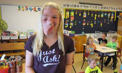 上天給的考驗！半臉畸形少女永不放棄的故事 Sarah Atwell、Neuro­fibromatosis、半臉畸形