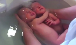 就是不想跟你分開！雙胞胎獻給彼此的第一個抱抱 雙胞胎、第一次、擁抱、雙胞胎、Sonia Rochel