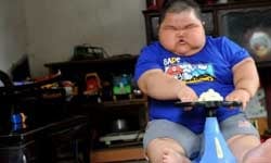 暴飲暴食吃到死？飢餓無限上綱的小胖威利症    飢餓、罕見疾病、小胖威利、肥胖、食欲