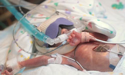 得來不易的一歲生日　早產兒父母令人動容的愛《First Year》 First Year、Ward Miles、早產兒、父母、愛