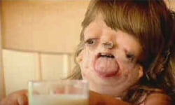 誰都不該為長相自卑...畸臉女孩Juliana Wetmore的故事 沒有臉、女孩、下頷骨、顏面、發育