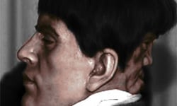 別想在他背後搞鬼！後腦杓長臉的男子Edward Mordake 詭異、恐怖、連體雙胞胎、雙胞胎、邪惡