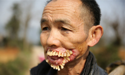 狼吻好毒！終極暴牙男和他的童年回憶 中國、狼吻、老人、貴州、暴牙