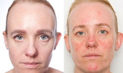 1個月老10歲！連續30天不卸妝就睡覺實驗 Anna Pursglove、化妝、卸妝、睡覺、蒼老、實驗