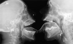 X光下Sex、肛門印吻痕！Wim Delvoye驚世駭俗的幽默藝術 屁眼、吻痕、X光、做愛、性事、驚世駭俗、幽默、藝術、搞怪、惡搞、Wim Delvoye