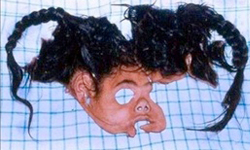 少女臉皮整塊被扯掉　世界第一例全臉植皮手術 全臉、植皮、少女、印度、手術