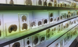 忘了帶腦來這裡找一個！收藏了600個腦的印度大腦博物館 印度、大腦、博物館、人類、動物