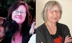 仆街女眼睛被狗啃掉　堅信「牠救了我」 狗啃、驚悚、吃掉、眼睛、眼球