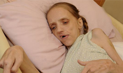 每日飲酒40杯　酗酒女35歲瀕死 啤酒、喝酒、飲酒、酗酒、女子