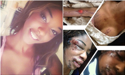 女模受夠了！悽慘家暴照PO網籲遠離恐怖情人 女模、家暴、恐怖情人、暴力、命危