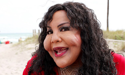 整形女遇假醫師　術後臉龐堅若磐石 整形、假醫師、醫生、冒牌、黑市