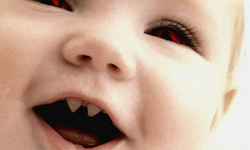 寶寶長牙了…長在腦內！開腦驚見牙齒、手腳事件簿 醫學、醫療、乳齒、長牙、手腳