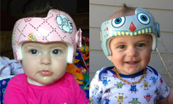 戴上它不再醜醜囉！嬰兒的矯正頭盔彩繪 辛普森家庭、梵谷、愛麗絲夢遊仙境、寶寶、頭型矯正器、Paula Strawn、美國隊長