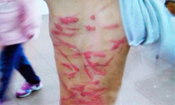 警方不受理虐童？虎媽毒打6歲兒、師震怒PO網 虐童、虎媽、毒打、痛打、虐打