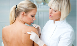 臉上的痣正在長大？你需要去看皮膚科的5個徵兆 皮膚科、求診、肌膚問題、季節轉換、皮膚