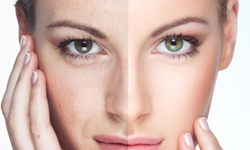 換膚一定要「酸」來「酸」去？盤點保養最常用的果酸種類與功能 酸、果酸、杏仁酸、胜肽酸、甘醇酸