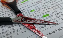 斷根一次還不夠！惡妻兩度閹夫 切屌、斷根、生殖器、閹割、陰莖