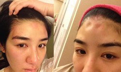 妞快報：公主沒有幸福快樂的日子！小燕子黃奕遭家暴額頭被打凹 妞快報、黃奕、小燕子、黃毅清、家暴