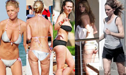 睡一覺醒來肥大的下半身就變小？破解抽脂迷思 抽脂、迷思、睡覺、打麻醉、整形、肥胖、瘦身、醫美、微整、沈予希