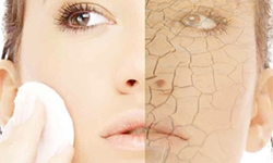 想擁有好皮膚就得吃對飯！各種膚質適宜的飲食法 ibeauty、膚質、內分泌、代謝、T字部、痘痘、粉刺、保養