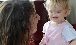 她的笑容可以拯救你 沒有鼻子的可愛小天使 Tessa Evans、笑容、罕病、天使