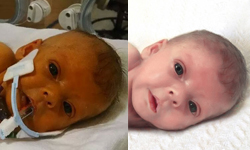 僅活6週的罕症女兒只有插管照！一位傷心欲絕的父親請網友神P圖… Nathan Steffel、Sophia、美國、併發症、罕見