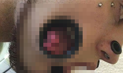 渾身是洞渾身是勁！擁有三張嘴的奇男子 獵奇、極限、藝術、洞、嘴巴