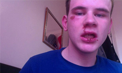 怎麼不去角逐最佳編劇？英國少年自編自導自演遭霸凌事件 英國、男孩、受害者、攻擊、同性戀