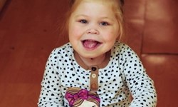 罕病讓萌娃慘變大舌頭！歷經多次手術終於會說話 罕病、蘿莉、萌娃、寶寶、罕見疾病