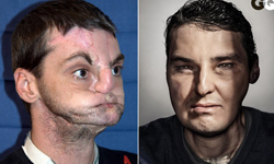 下半臉全被散彈槍毀掉　毀容男重生登上GQ 散彈槍、GQ、雜誌、模特兒、重生、勵志、面部全毀、毀容、Richard Lee Norris