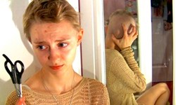 拔了又長、長了再拔！美麗少女的拔毛癖自拍計畫 拔毛癖、Rebecca Brown、Trichotillomania、Beckie0、精神病