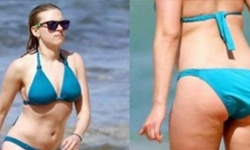 其實男生也會長橘皮！10種關於橘皮組織的迷思 橘皮、組織、橘皮組織、脂肪、瘦子