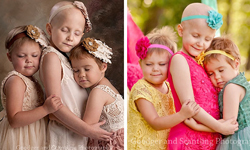 「你不是一個人！」3位癌症女童的感動你心攝影集 Lora Scantling、Ainsley Peters、Rheann Franklin、Rylie Hughey、攝影