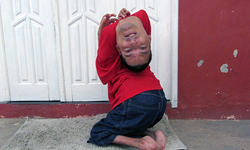 「我的世界才沒因此而顛倒！」巴西男天生頭部倒著長 頭、巴西、顛倒、勵志、先天、男子、不放棄、嚇人、罕見、獵奇