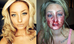 吻得慷慨激昂、鮮血四射！正妹遭醋男友暴吻而毀容 恐怖情人、變態、傷害、血、情侶、傻眼、罪行、驚人、漂亮、血淋淋