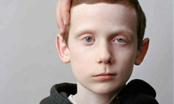 這不是在耍帥斜嘴笑 顏面神經麻痺者的人像攝影  顏面神經癱瘓、 About Face、 Sage Sohier、美國、波士頓、肉毒桿菌、藝術