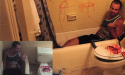 一覺醒來腎不見！整人新招連大男人也崩潰 整人毒招出現！受害者崩潰以為腎臟被偷